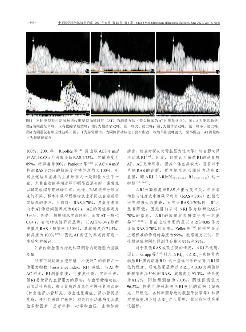【影像领域】肾动脉狭窄的超声诊断专家共识