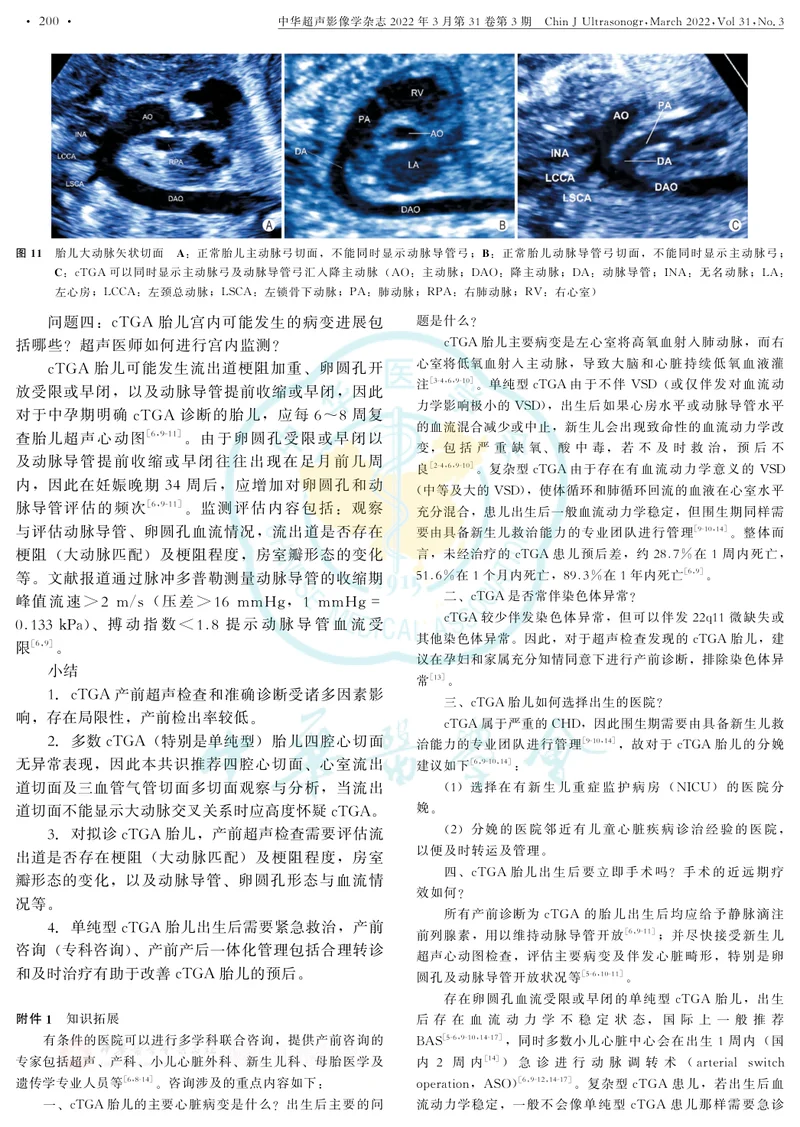 胎儿完全型大动脉转位中孕期超声检查中国专家共识(2022版)