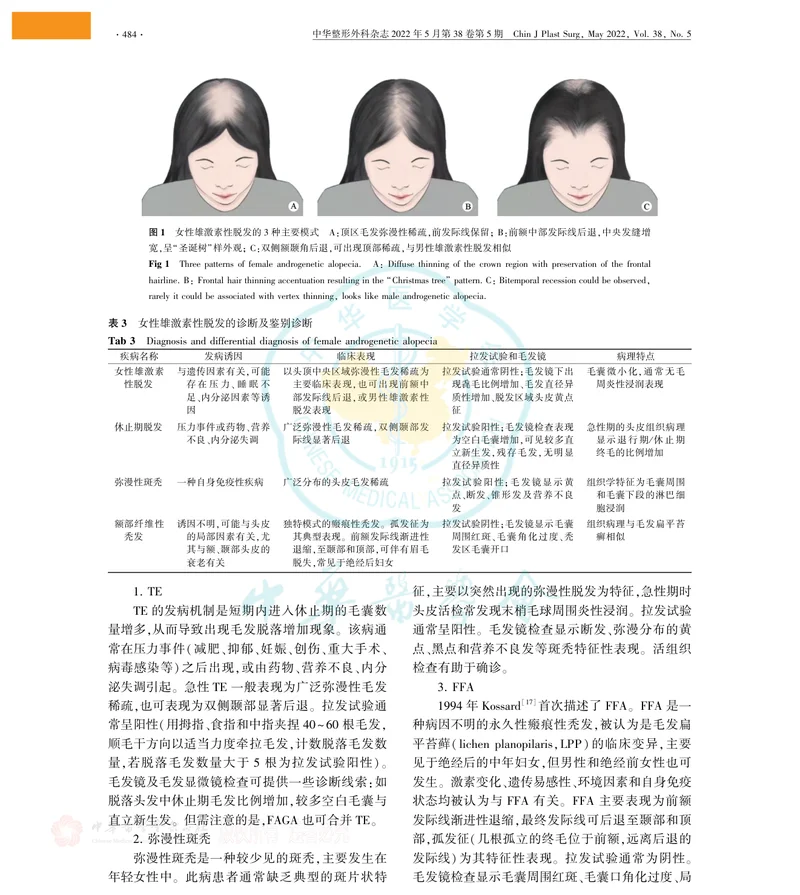 女性雄激素性脱发诊断与治疗中国专家共识(2022版)