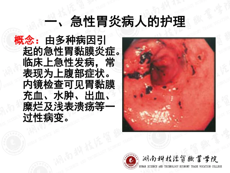 胃炎的护理