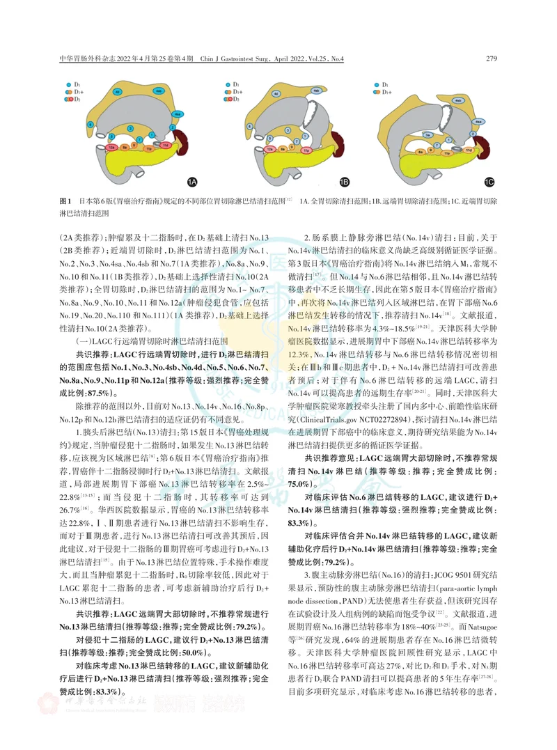 局部进展期胃癌规范化淋巴结清扫范围中国专家共识（2022版）