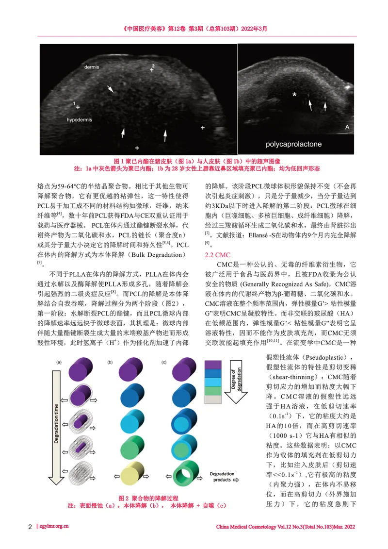 Ellansé 的材料特性及鼻唇沟填充的专家共识
