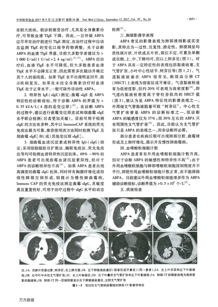 变应性支气管肺曲霉病诊治专家共识