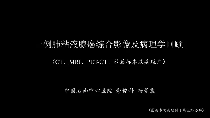 一例肺粘液腺癌综合影像及病理学回顾