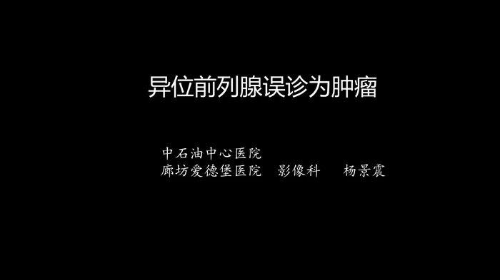 异位前列腺误诊为肿瘤