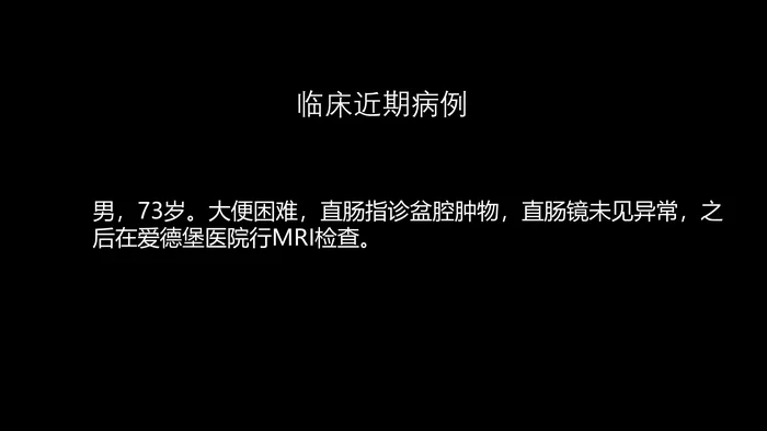 异位前列腺误诊为肿瘤
