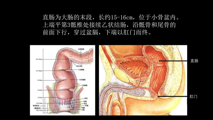 直肠癌：MRI与临床