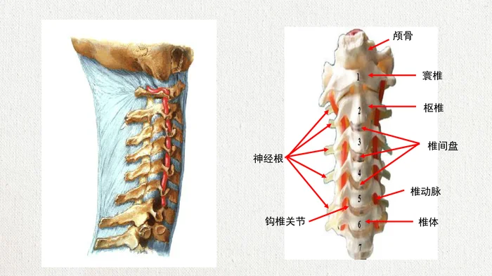 脊髓型颈椎病患者的个案护理查房