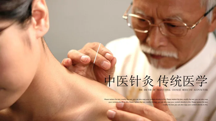 中医针灸 传统医学